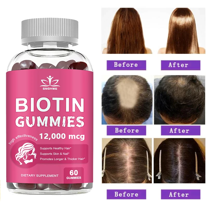 4-in-1 Collagen + Biotin Gummies for Women & Men – Hair, Skin, Nail & Joint Support with Vitamin C & E | Delicious Strawberry Flavor